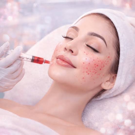 Vampire Facial